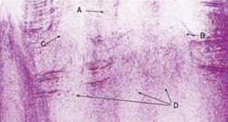 Th Black11 0811off Th Black11 0811off