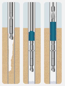 Sand clean out and screen installation by Filtrex is performed across three key stages. Sand clean out and screen installation by Filtrex is performed across three key stages.