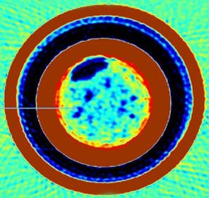 Tracerco's Discovery insights show extent of deposit in the pipeline. Tracerco's Discovery insights show extent of deposit in the pipeline.
